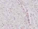 Integrase interactor 1 (INI-1)/SNF5/SMARCB1 Recombinant Rabbit Monoclonal Antibody (SMARCB1/4587R)
