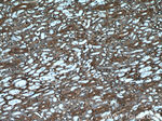 beta Actin Antibody in Immunohistochemistry (Paraffin) (IHC (P))