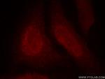 DDB1 Antibody in Immunocytochemistry (ICC/IF)