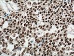 DDB1 Antibody in Immunohistochemistry (Paraffin) (IHC (P))