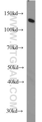 DDB1 Antibody in Western Blot (WB)