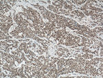 DDB1 Antibody in Immunohistochemistry (Paraffin) (IHC (P))