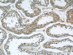 DDB1 Antibody in Immunohistochemistry (Paraffin) (IHC (P))