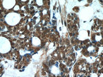 DDB1 Antibody in Immunohistochemistry (Paraffin) (IHC (P))