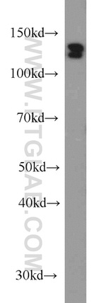 DDB1 Antibody in Western Blot (WB)