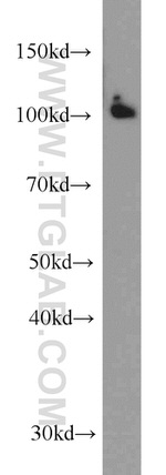 DDB1 Antibody in Western Blot (WB)