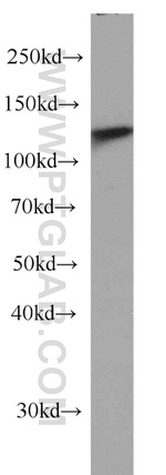 DDB1 Antibody in Western Blot (WB)