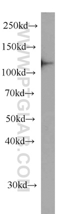 DDB1 Antibody in Western Blot (WB)