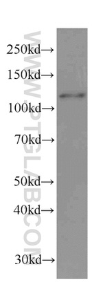 DDB1 Antibody in Western Blot (WB)