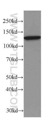 DDB1 Antibody in Western Blot (WB)