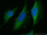 SEC5/EXOC2 Antibody in Immunocytochemistry (ICC/IF)