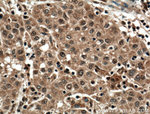 SEC5/EXOC2 Antibody in Immunohistochemistry (Paraffin) (IHC (P))