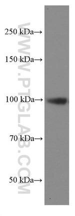 SEC5/EXOC2 Antibody in Western Blot (WB)