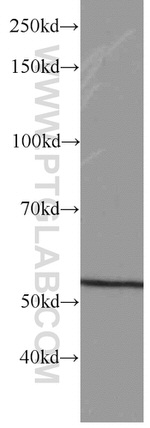 GEFT Antibody in Western Blot (WB)
