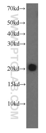 MAD2L1 Antibody in Western Blot (WB)