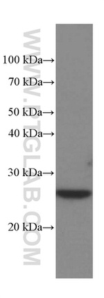 MAD2L1 Antibody in Western Blot (WB)