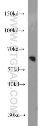 Transketolase Antibody in Western Blot (WB)