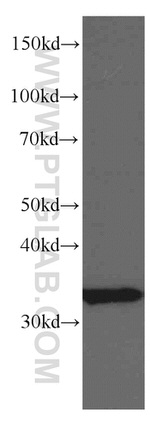TST Antibody in Western Blot (WB)