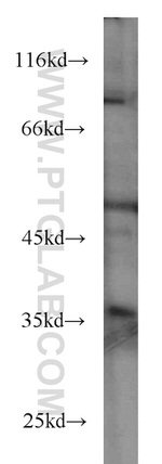 Bcl-XL Antibody in Western Blot (WB)