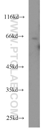 CDC6 Antibody in Western Blot (WB)