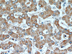 CYB5R3 Antibody in Immunohistochemistry (Paraffin) (IHC (P))