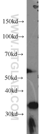 CYB5R3 Antibody in Western Blot (WB)