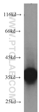CYB5R3 Antibody in Western Blot (WB)