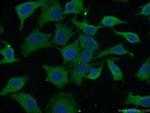 EIF3D Antibody in Immunocytochemistry (ICC/IF)
