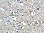 EIF3D Antibody in Immunohistochemistry (Paraffin) (IHC (P))