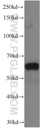 EIF3D Antibody in Western Blot (WB)