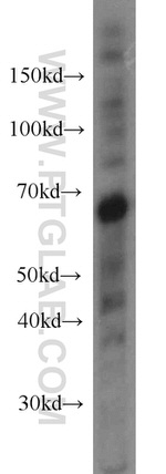 EIF3D Antibody in Western Blot (WB)