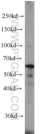 EIF3D Antibody in Western Blot (WB)