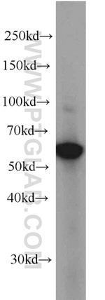 EIF3D Antibody in Western Blot (WB)