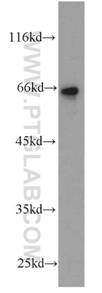 EIF3D Antibody in Western Blot (WB)