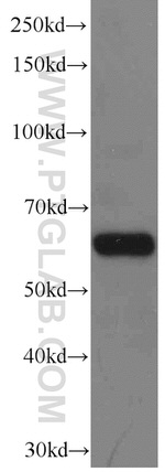 EIF3D Antibody in Western Blot (WB)