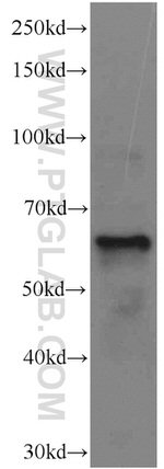EIF3D Antibody in Western Blot (WB)