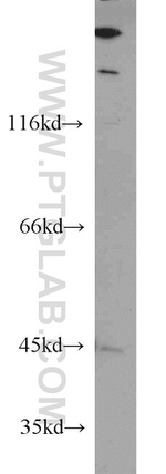IVD Antibody in Western Blot (WB)