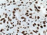 TTF-1 Antibody in Immunohistochemistry (Paraffin) (IHC (P))