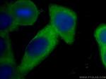 Annexin A2 Antibody in Immunocytochemistry (ICC/IF)