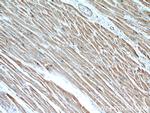CPT1A Antibody in Immunohistochemistry (Paraffin) (IHC (P))