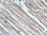 CPT1A Antibody in Immunohistochemistry (Paraffin) (IHC (P))