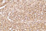 CPT1A Antibody in Immunohistochemistry (Paraffin) (IHC (P))