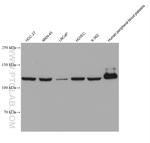 CPT1A Antibody in Western Blot (WB)