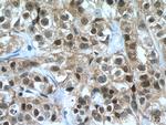 FKBP52 Antibody in Immunohistochemistry (Paraffin) (IHC (P))