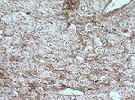 Fibronectin Antibody in Immunohistochemistry (Paraffin) (IHC (P))