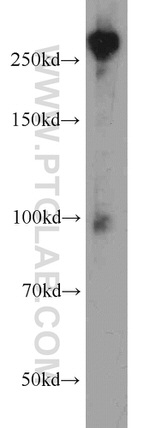 Fibronectin Antibody in Western Blot (WB)