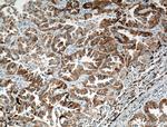 LPCAT1 Antibody in Immunohistochemistry (Paraffin) (IHC (P))