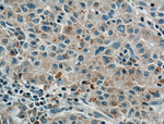 LPCAT1 Antibody in Immunohistochemistry (Paraffin) (IHC (P))