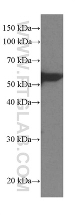 LPCAT1 Antibody in Western Blot (WB)