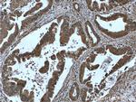 IA-2/PTPRN Antibody in Immunohistochemistry (Paraffin) (IHC (P))